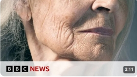 New skin research could help slow signs of ageing